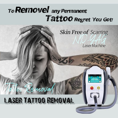 Perlakuan laser untuk menghilangkan tato vena varikos