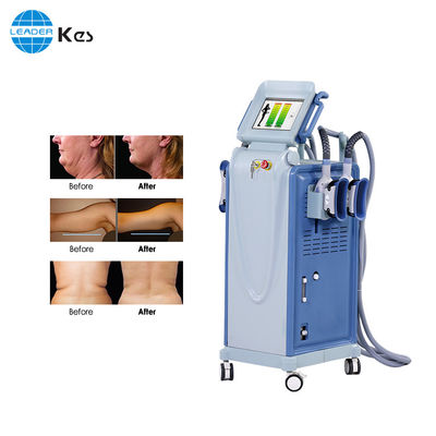 Vakuum Dan Teknologi LCD Mesin Cryolipolysis Untuk Kehilangan Lemak yang Aman Dan Efektif