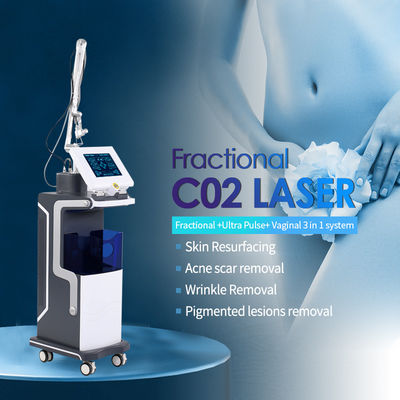 Mesin Laser Fraksi CO2 Solusi Tercanggih Untuk Penghapusan Parut